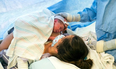 ¿Han cambiado los protocolos en los partos por cesárea?