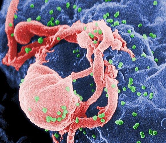 Una vacuna logra reducir en un 32% el riesgo de contraer el SIDA 