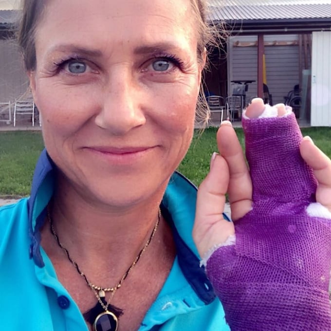 El accidente que ha sufrido Marta Luisa de Noruega durante sus vacaciones