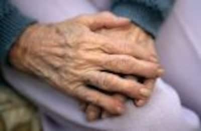 Problemas cutáneos más comunes en las personas mayores