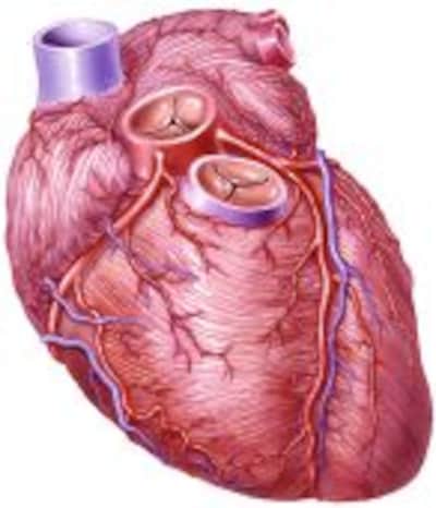 Trombosis coronaria
