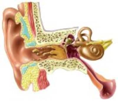 Otalgia (dolor de oídos)