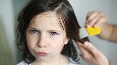 ¿Tu hijo tiene piojos? Hazte ya con este tratamiento 'todo en uno' para eliminarlos rápidamente