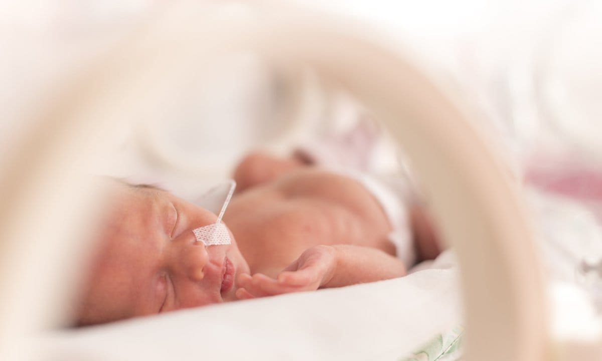 Bebés prematuros en incubadoras.