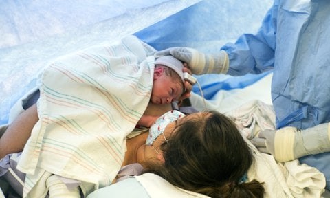 Mujer dando a luz mediante cesárea con su hijo en brazos
