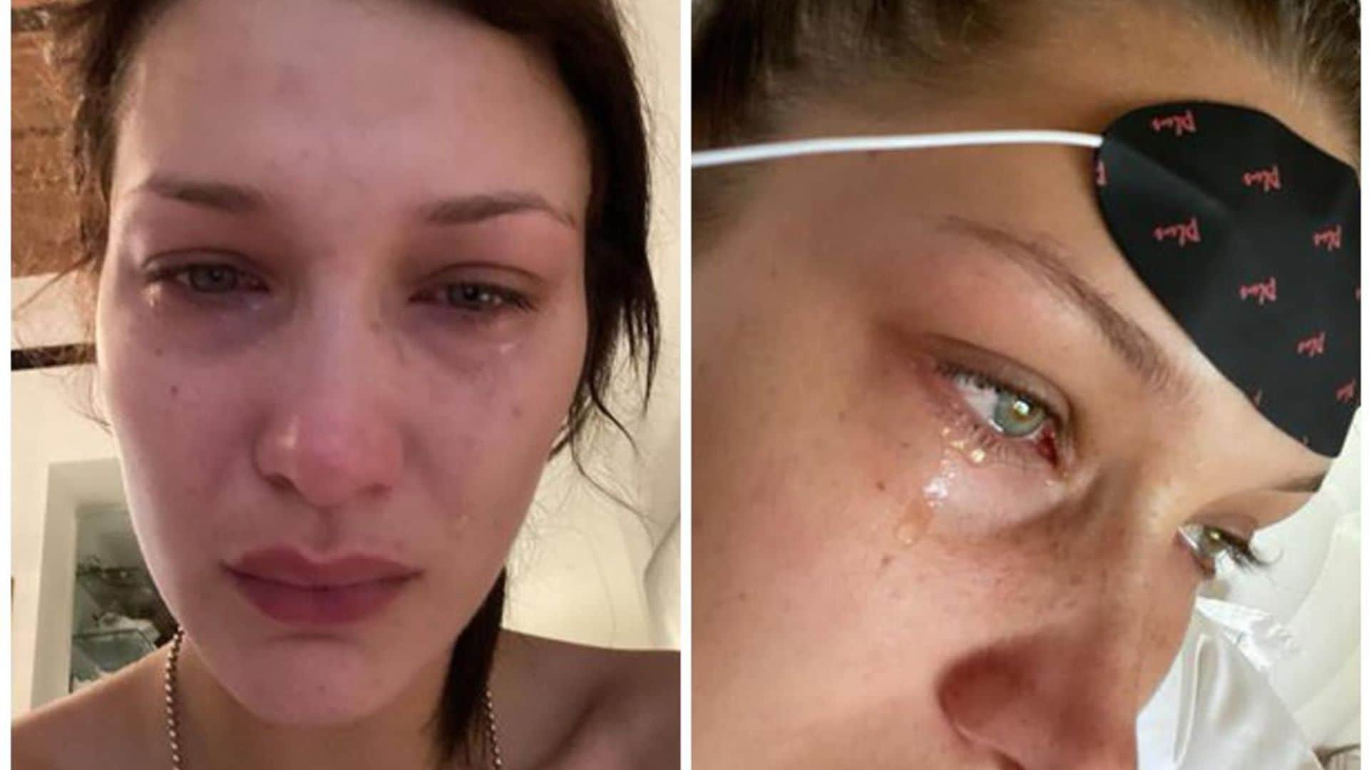 Bella Hadid shares 9 photos of her crying and tells fans ‘social media is not real’