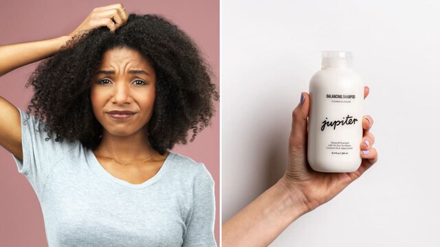 Woman dandruff