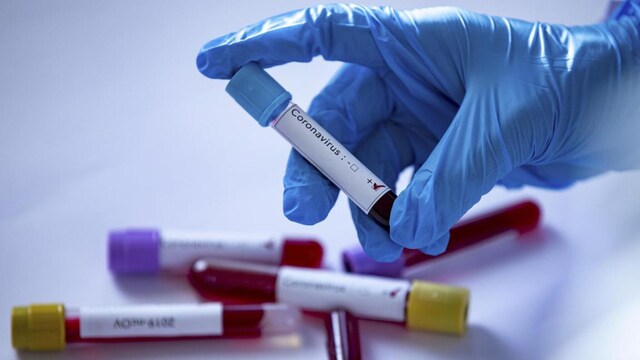 Royal's relative dies of coronavirus