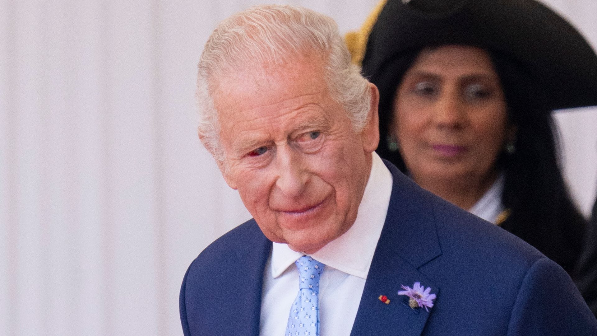 King Charles steps out with bloodshot eye—what happened?