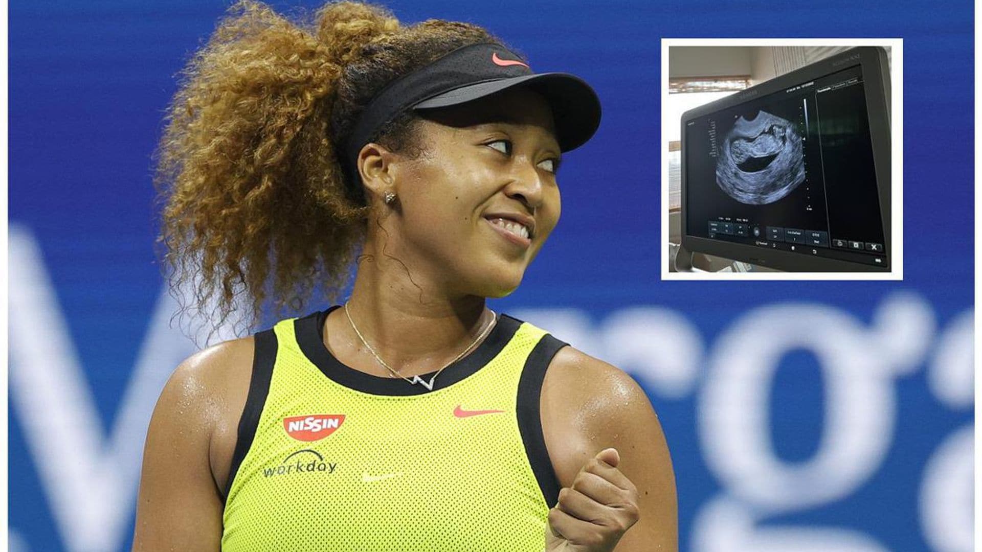 Naomi Osaka is pregnant! Athlete announces she won’t play in 2023