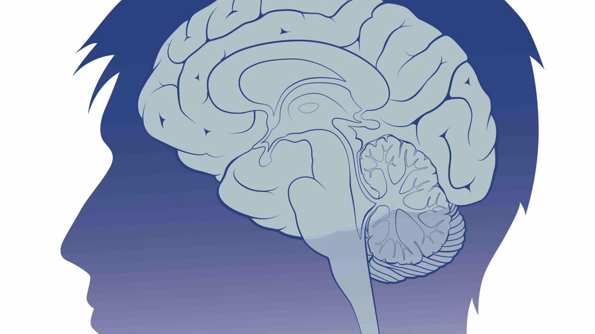 How an AI brain implant helps a stroke survivor communicate in Spanish and English