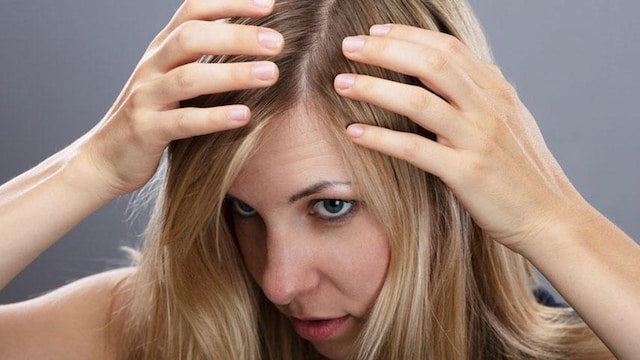 Scalp care