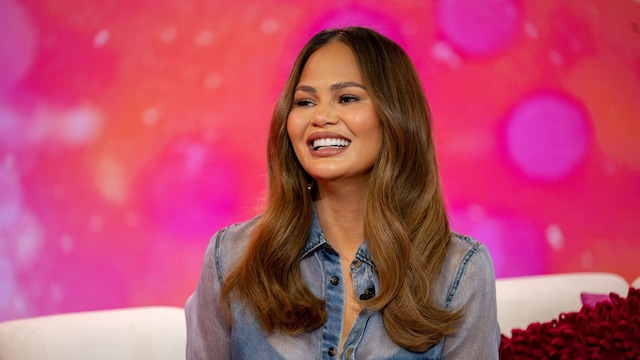 Chrissy Teigen had hairline surgery