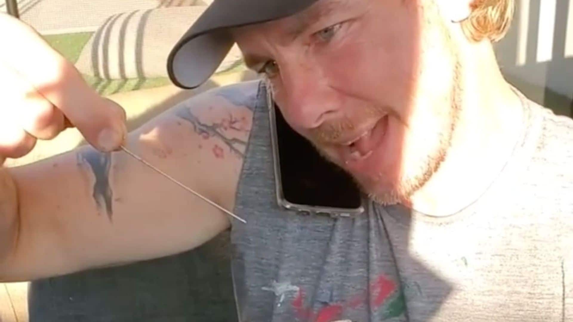 Dax Shepard does his own surgery, Shakira uplifts frontline workers and more news