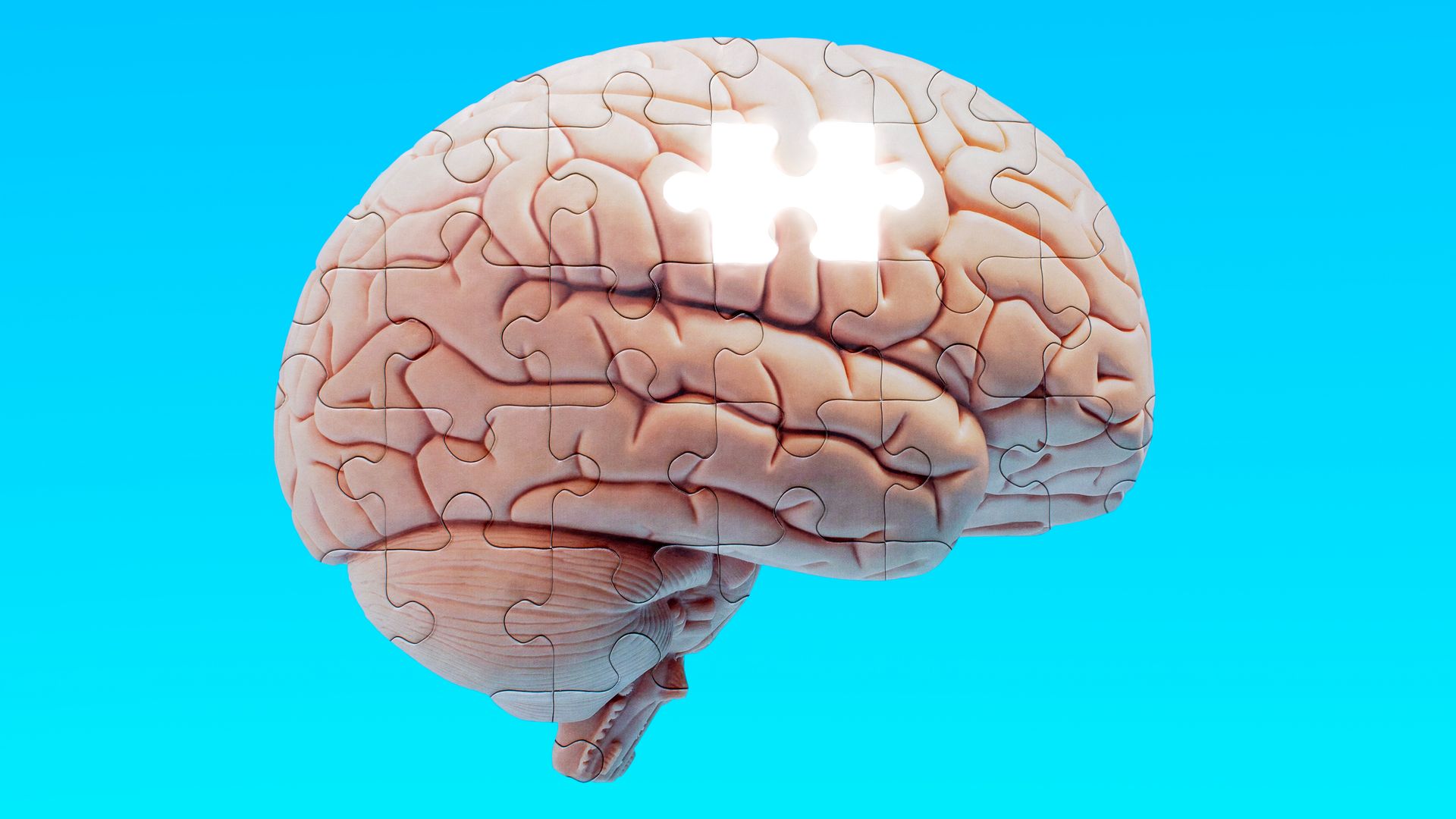 Surprisingly simple path to prevent dementia