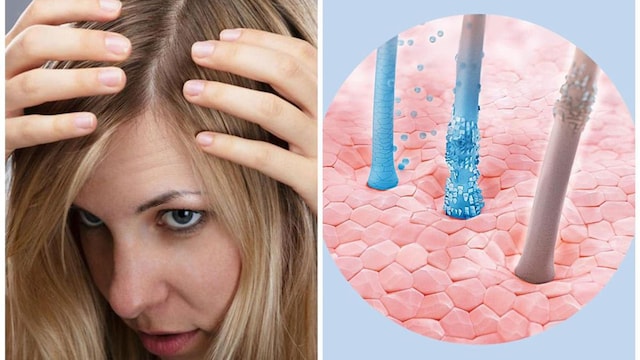 Dandruff, greasiness, or itchiness? Dr. Annie Gonzalez shares at-home scalp care remedies
