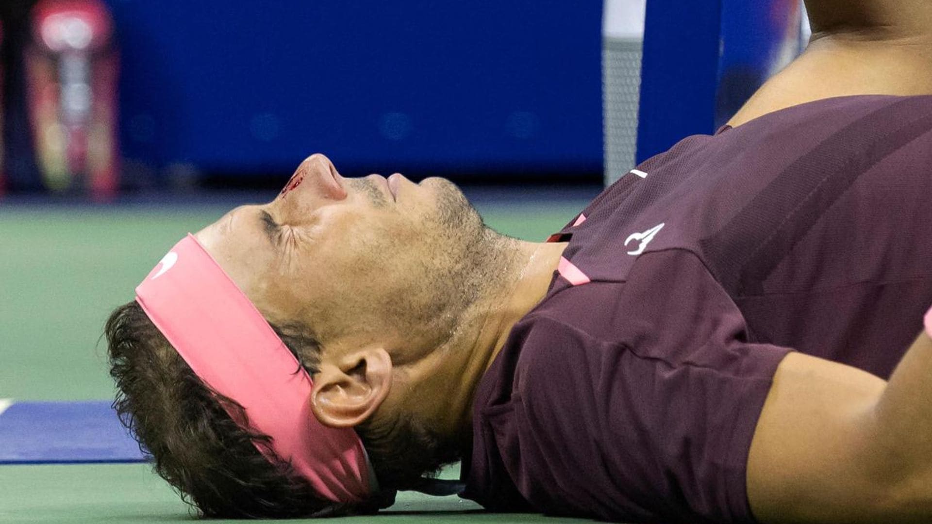 Rafael Nadal ended up with a bleeding nose after accidentally hitting himself during the U.S Open