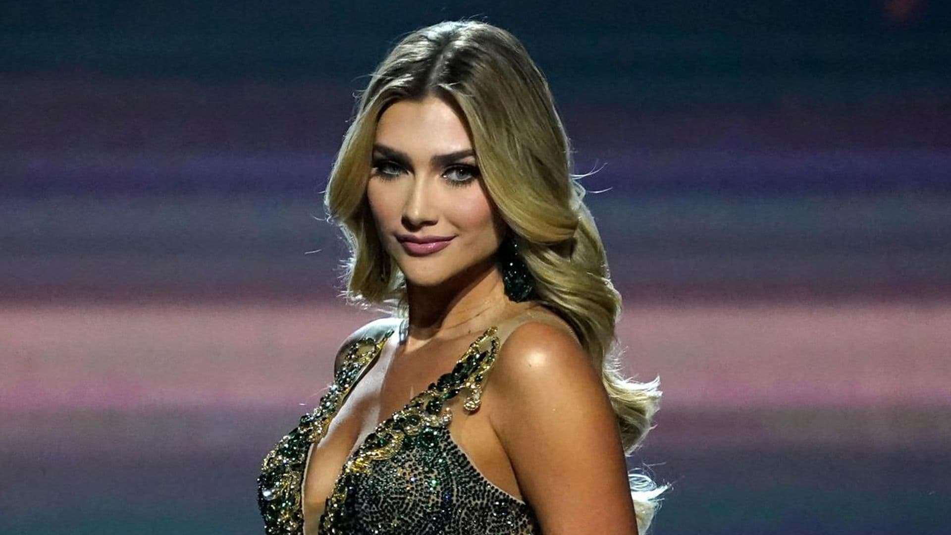 Miss Universe Colombia loves her imperfections in new post