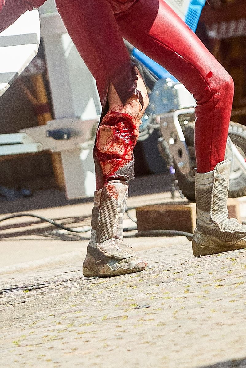 

After the model's stunt scene in the motorcycle accident, Bella Hadid reprises her role with a very serious leg injury while filming a scene for the series "The Beauty" in Paris.