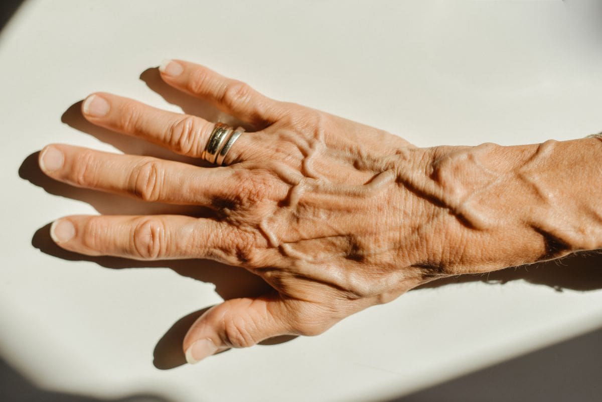 The condition itself is all too familiar for millions of Americans, especially those over 50