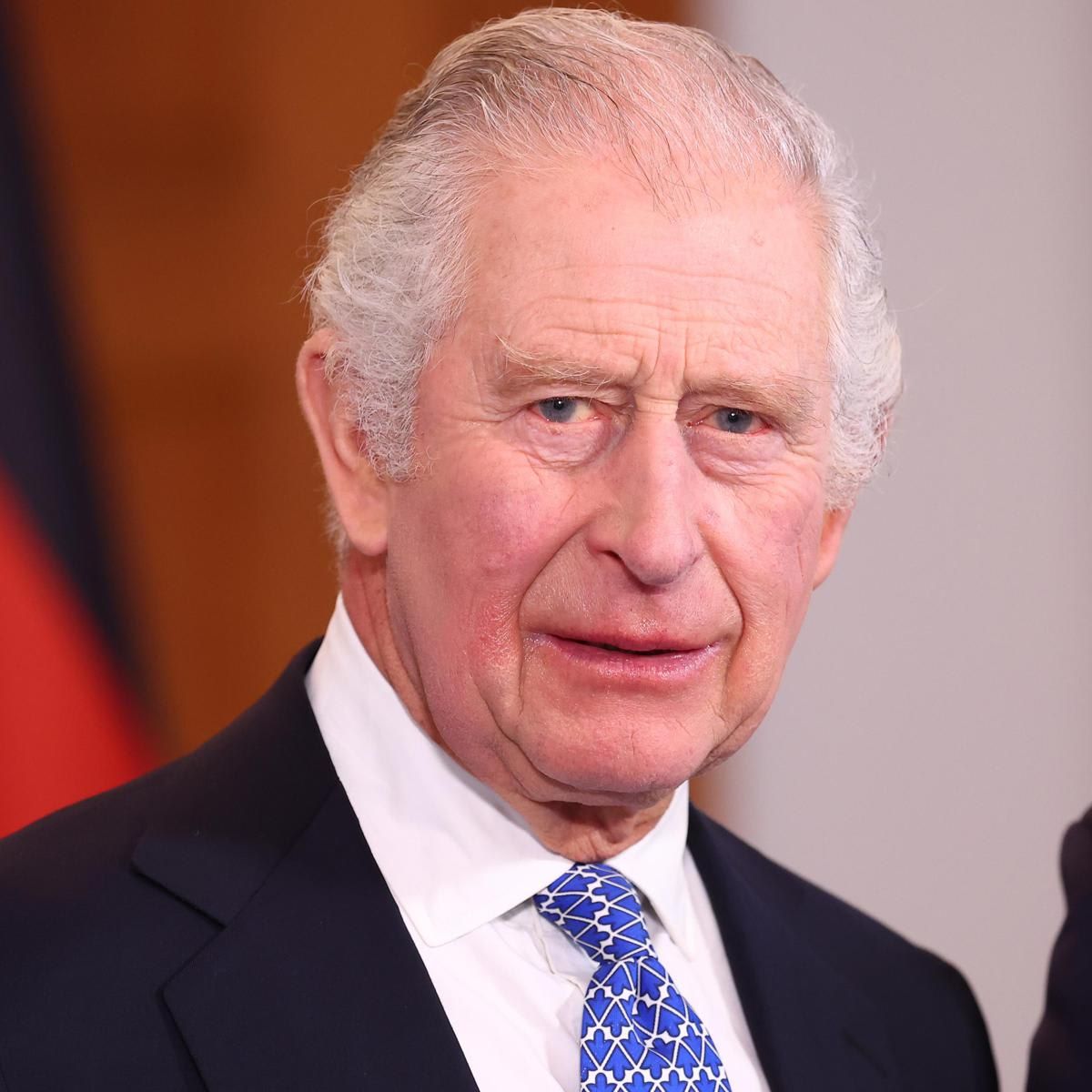 King Charles is seeking treatment for an enlarged prostate