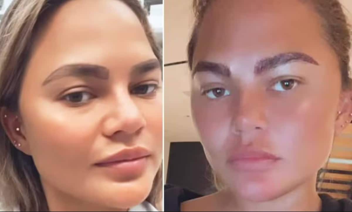 Chrissy had an eyebrow transplant in 2021