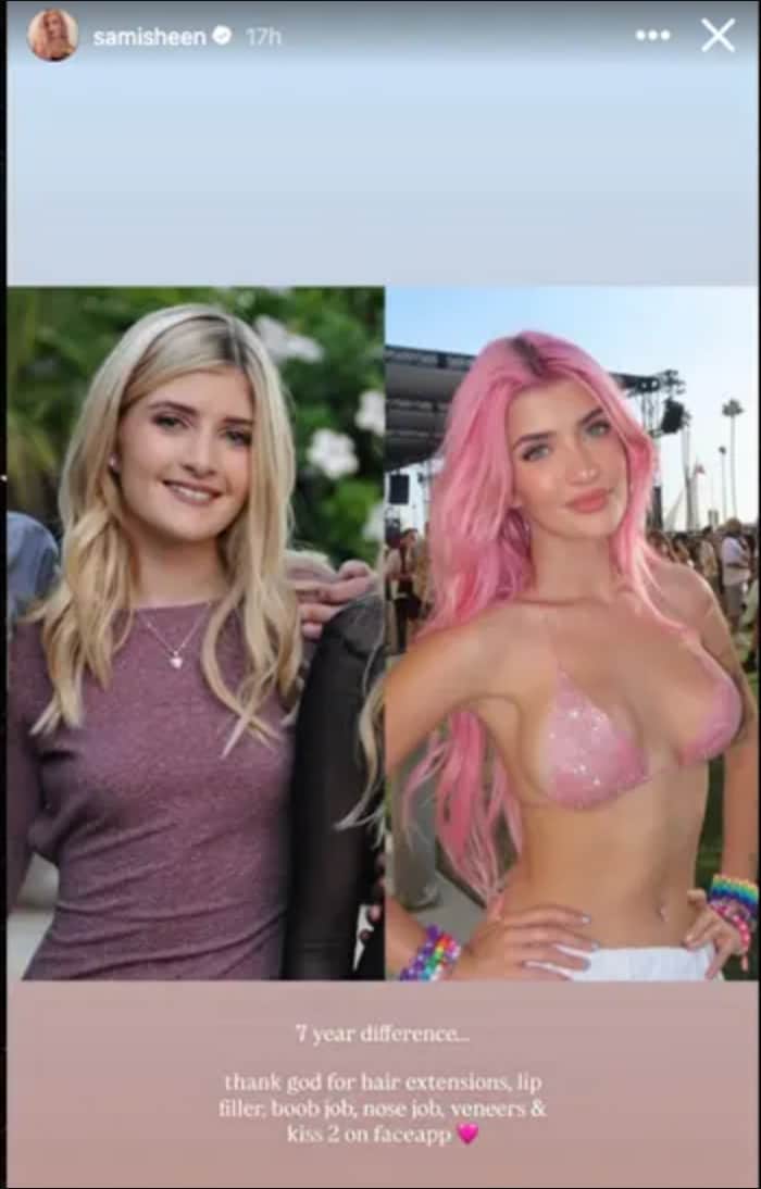 Sami is choosing transparency 