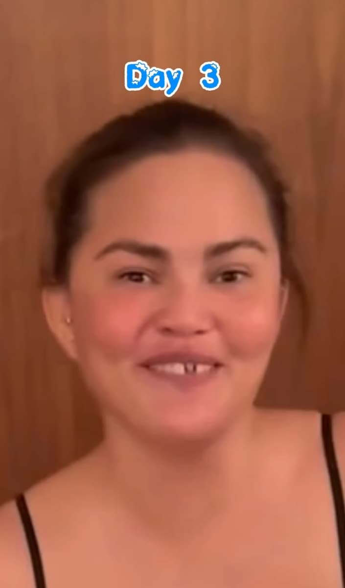 Chrissy is always down to share embarrassing moments