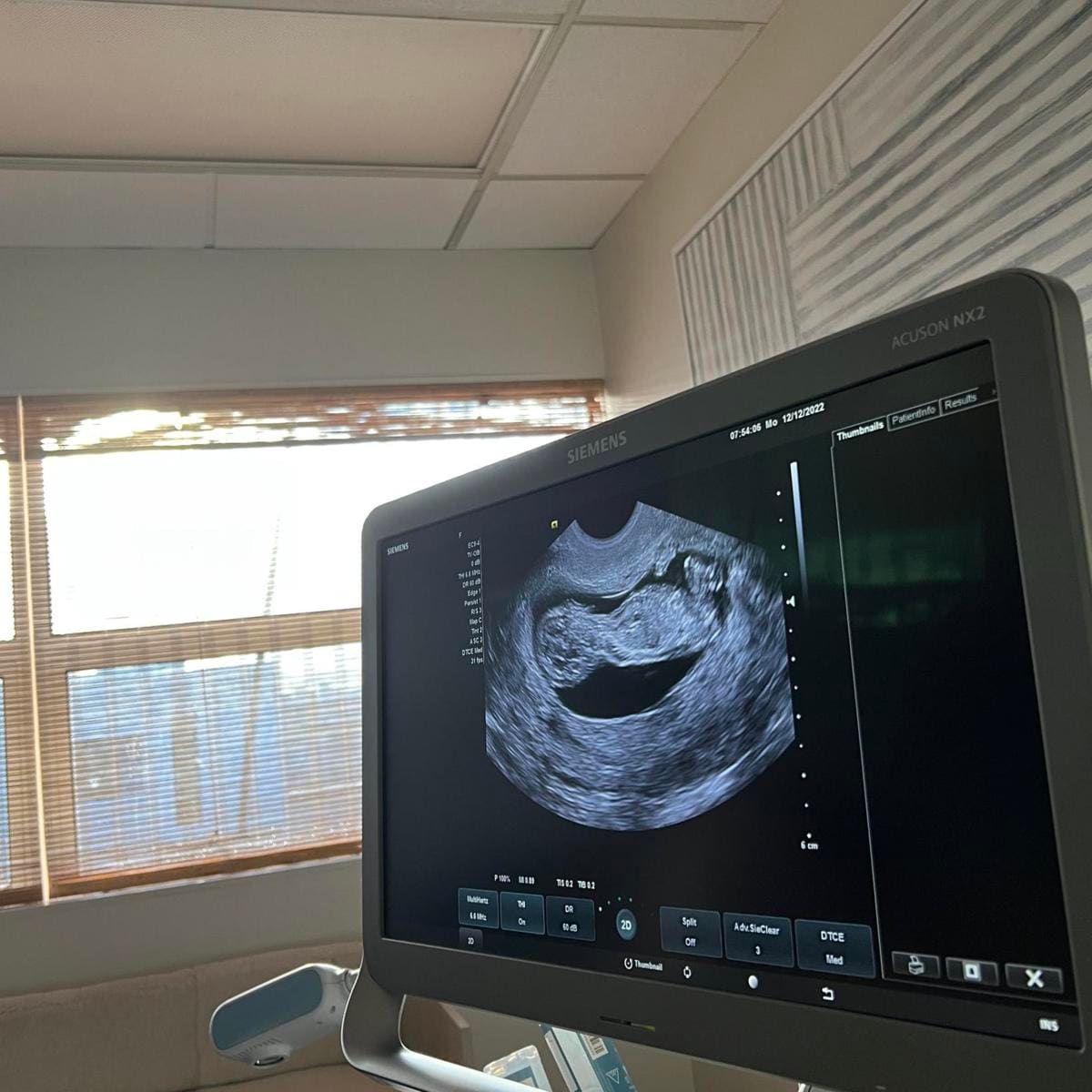 Naomi Osaka is pregnant!