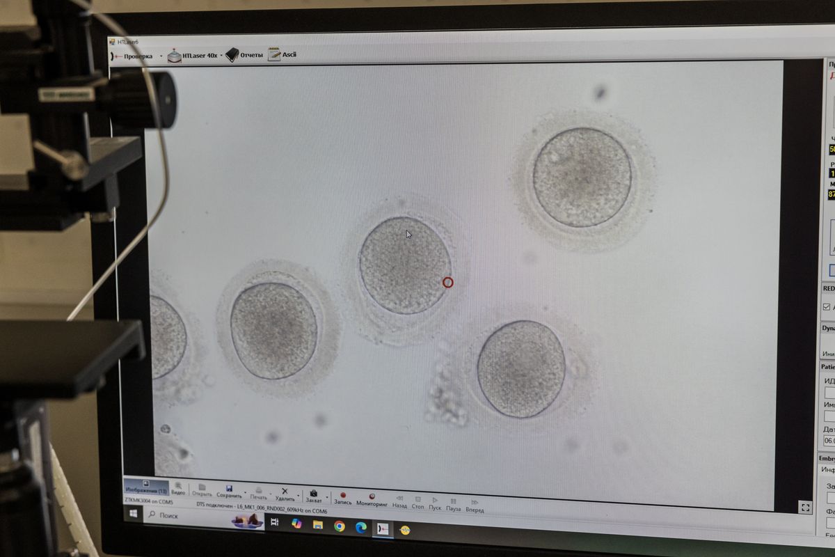 As eggs age, genetic, structural, and cellular changes can affect how successfully an egg fertilizes and develops into a chromosomally normal embryo capable of resulting in a healthy baby.