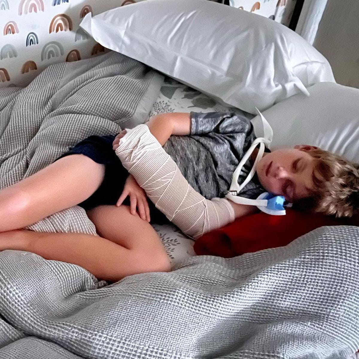 Ivanka Trump son Theo breaks his wrist