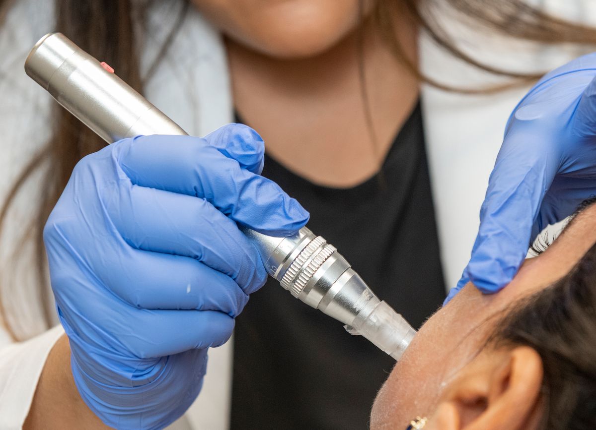  Dr. Yeral Patel uses a microneedle pen to apply a hyaluronic acid treatment for acne scars on patient Karima Gulick.