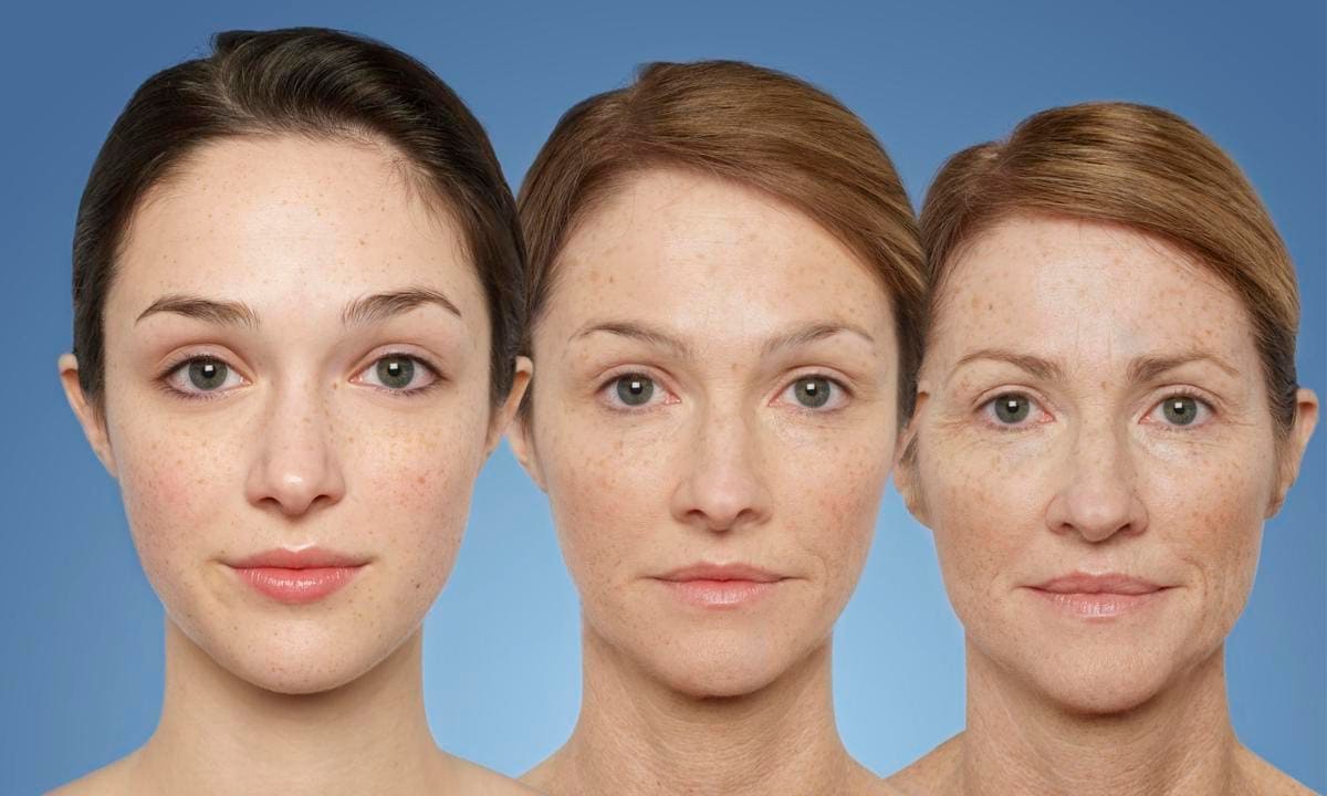 Aging