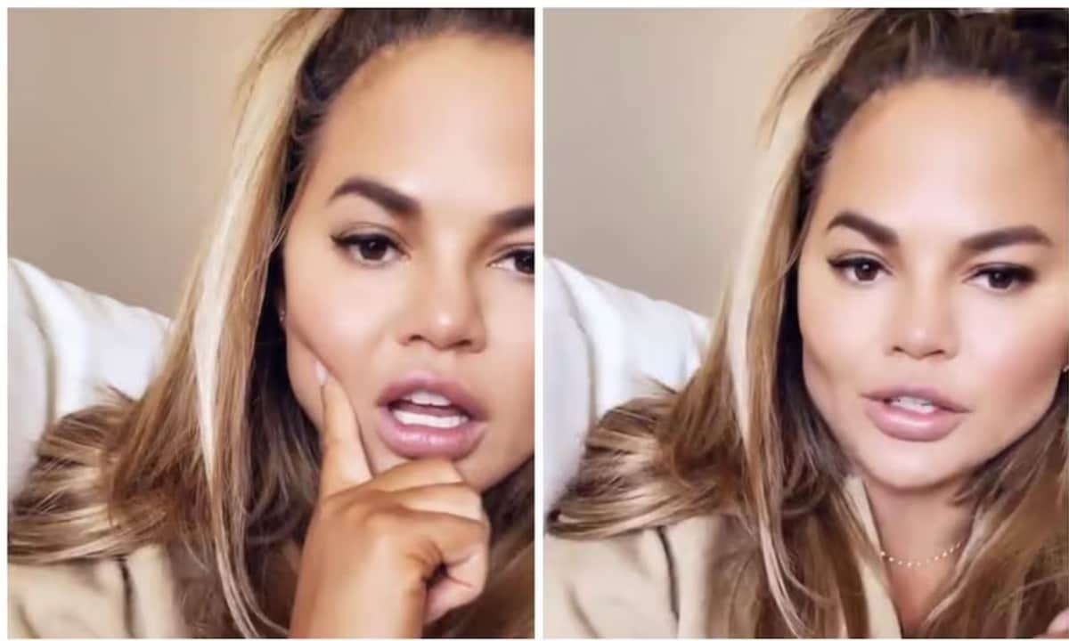 Chrissy showed off her buccal fat removal in 2021