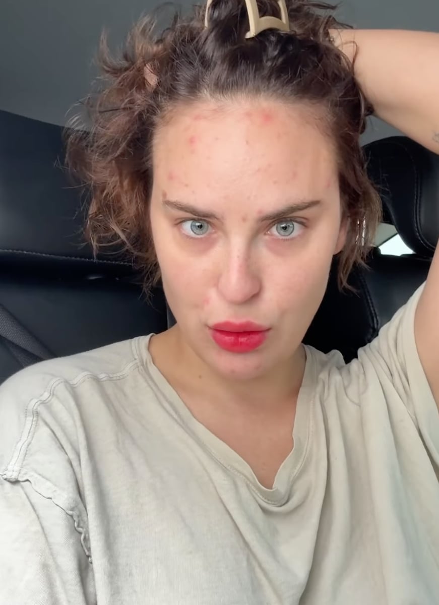 Her “before” photo revealed scabbed-over cuts and blemishes around her nose and eyes.