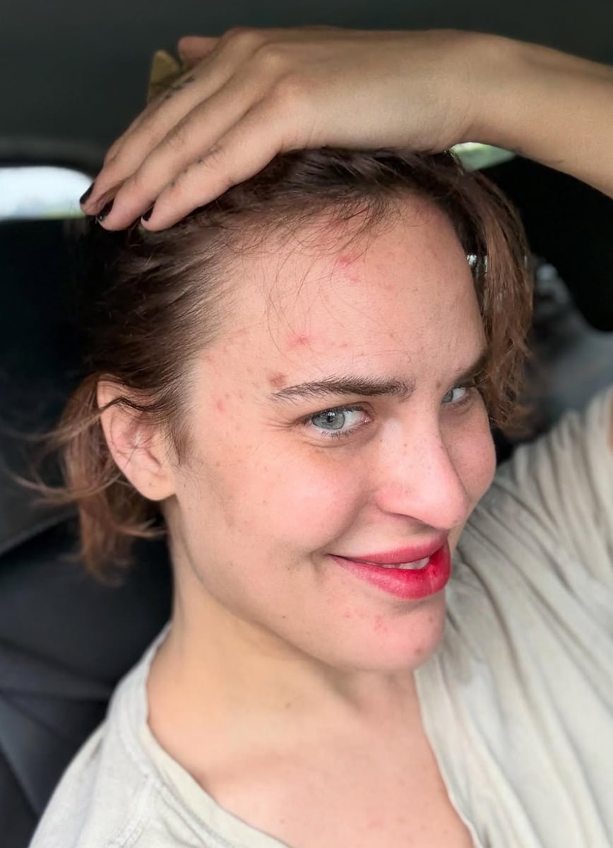 The condition is classified as a type of obsessive-compulsive disorder (OCD).