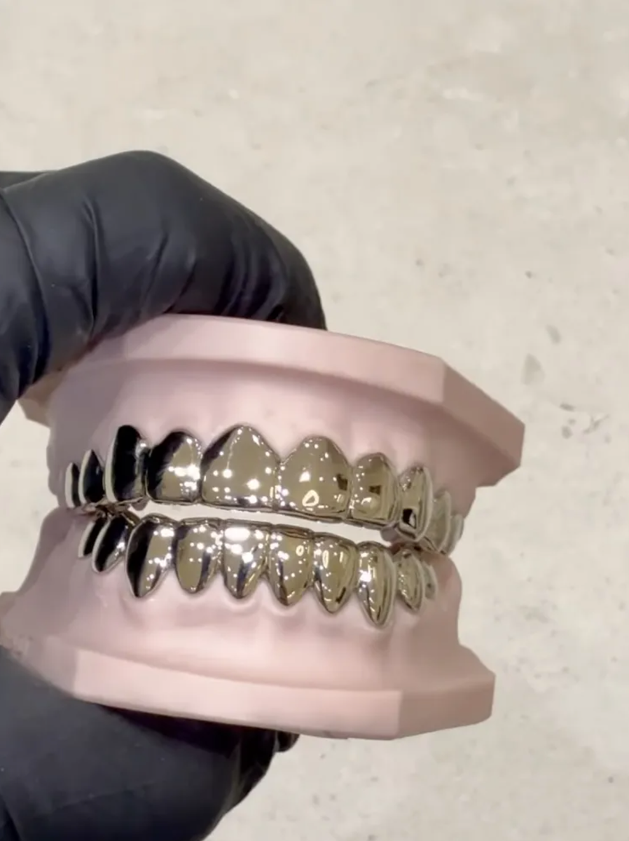 North West’s White Gold Grill Era Is Here—and It’s Already Defining Gen Alpha Style