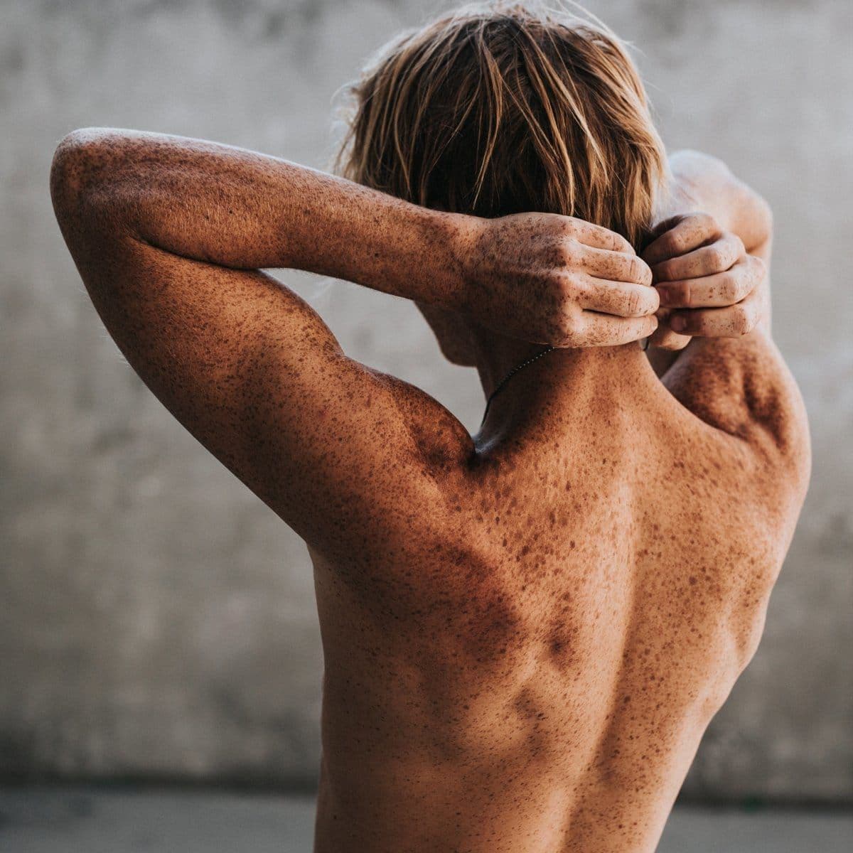 Skin Cancer Awareness Month: Reasons why now is the best time to get your skin checked out