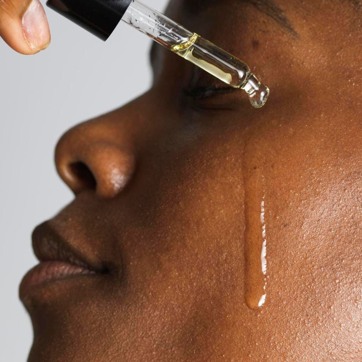 Hyaluronic acid
