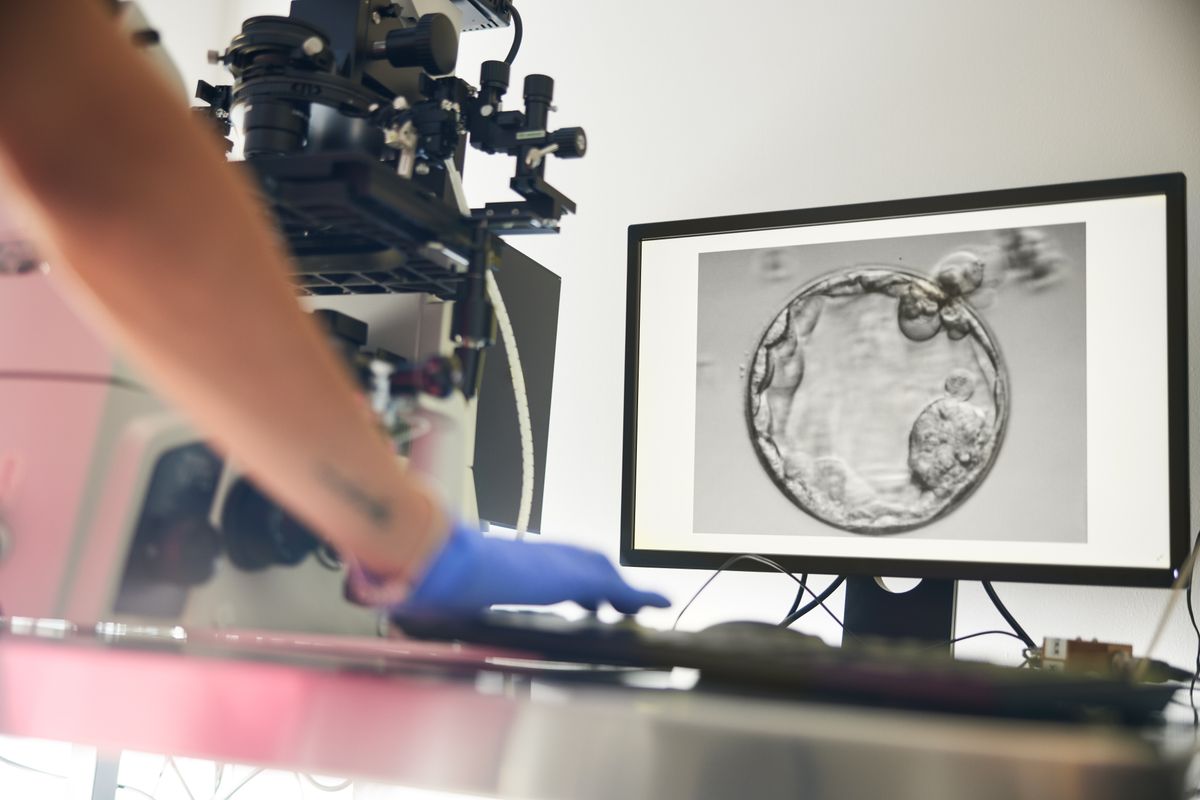 Patients are monitored closely with ultrasound and blood tests throughout stimulation partly to identify people at higher risk.