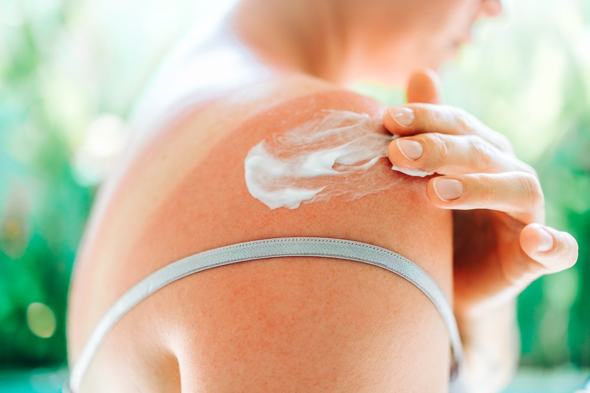 While most sunscreens sold in the United States effectively block ultraviolet B (UVB) rays that cause sunburn, many experts argue they do not provide sufficient protection against ultraviolet A (UVA) rays.