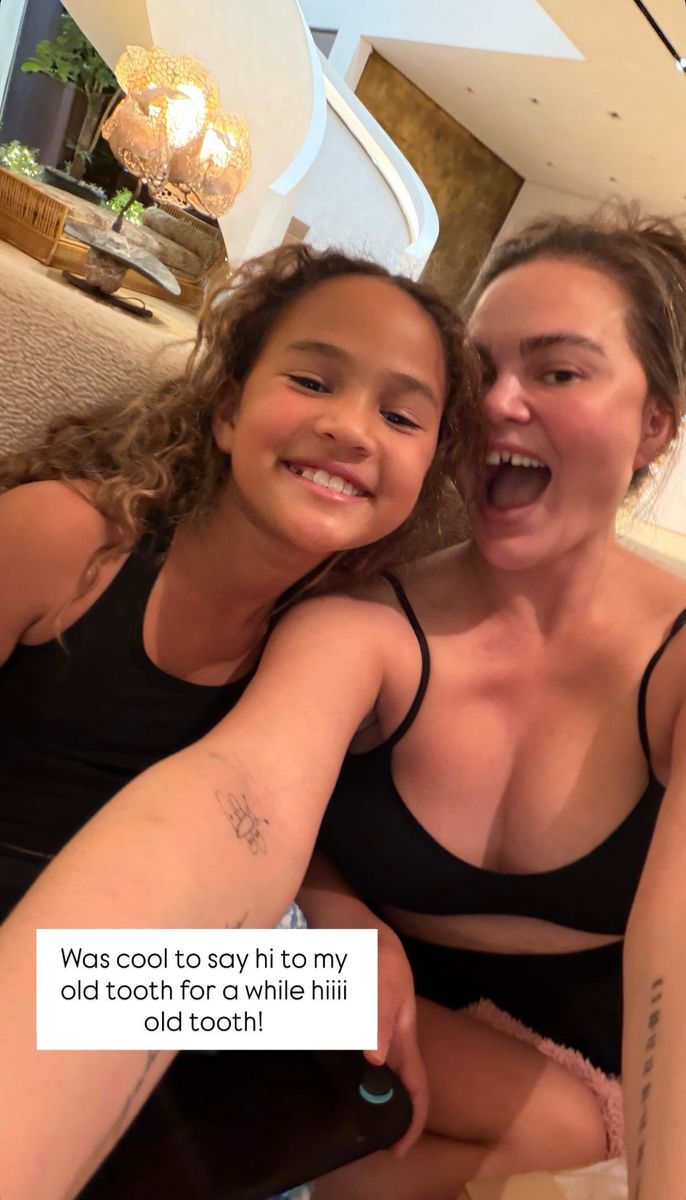 Chrissy joked that it was fun saying hi to her old tooth