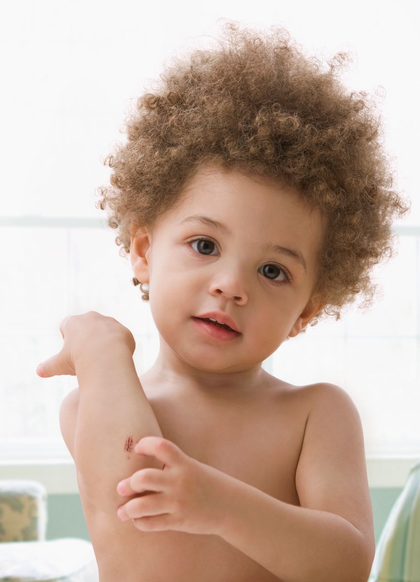 Symptoms include red streaks, fever, swollen lymph nodes, and pain.