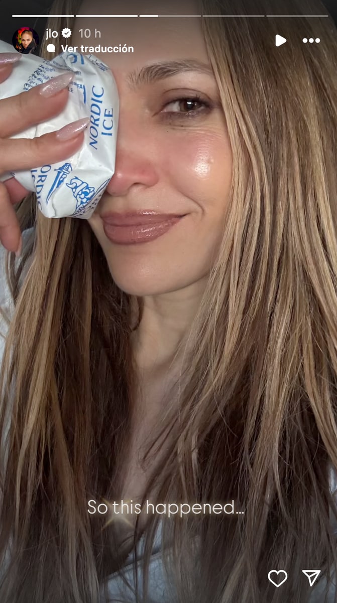 On Tuesday, May 13, the "Love Don't Cost a Thing" singer posted a Story showing off a gnarly-looking cut across the bridge of her famously flawless nose.