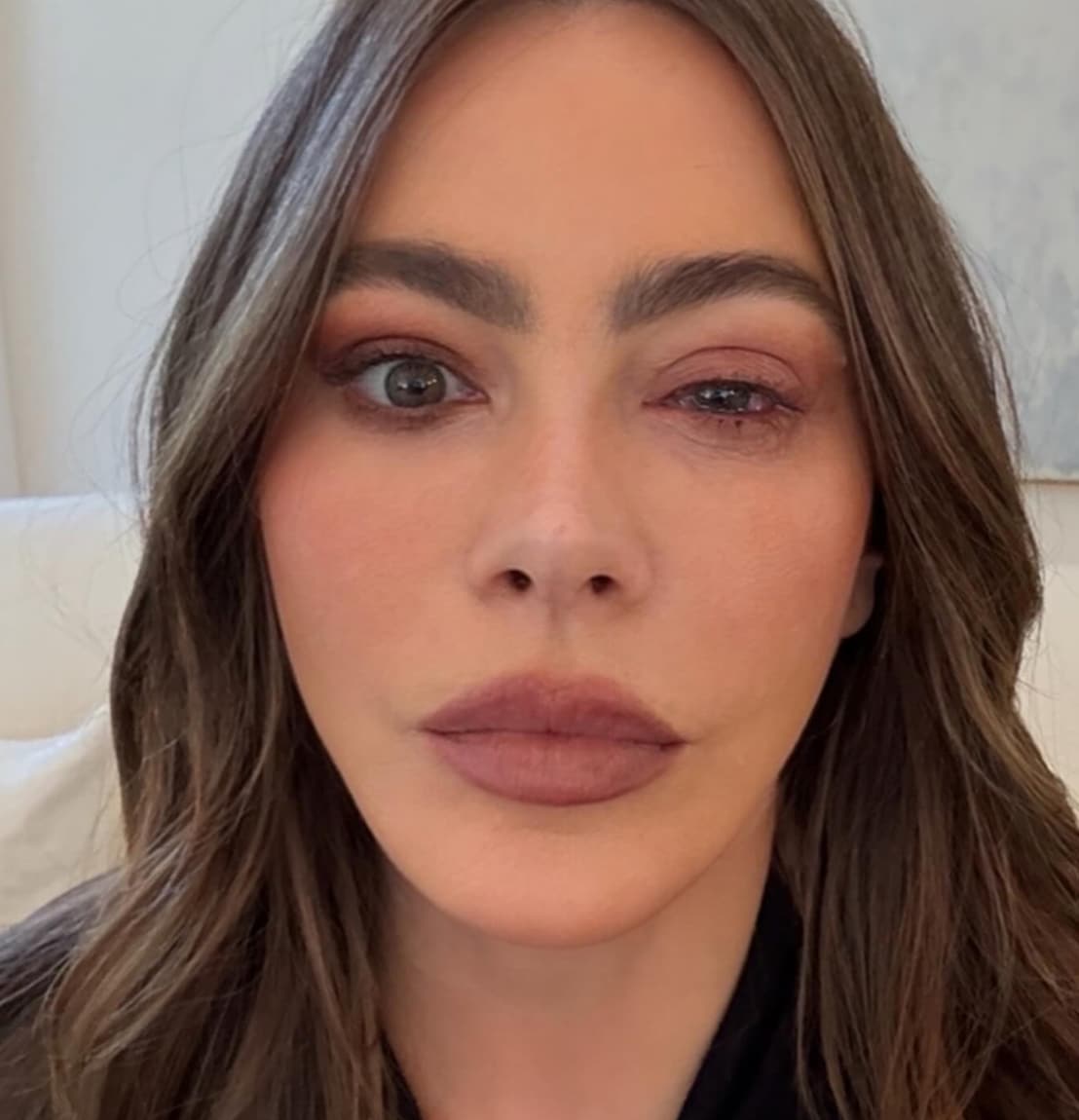 The actress shared images of her visibly swollen left eye along with a humorous apology
