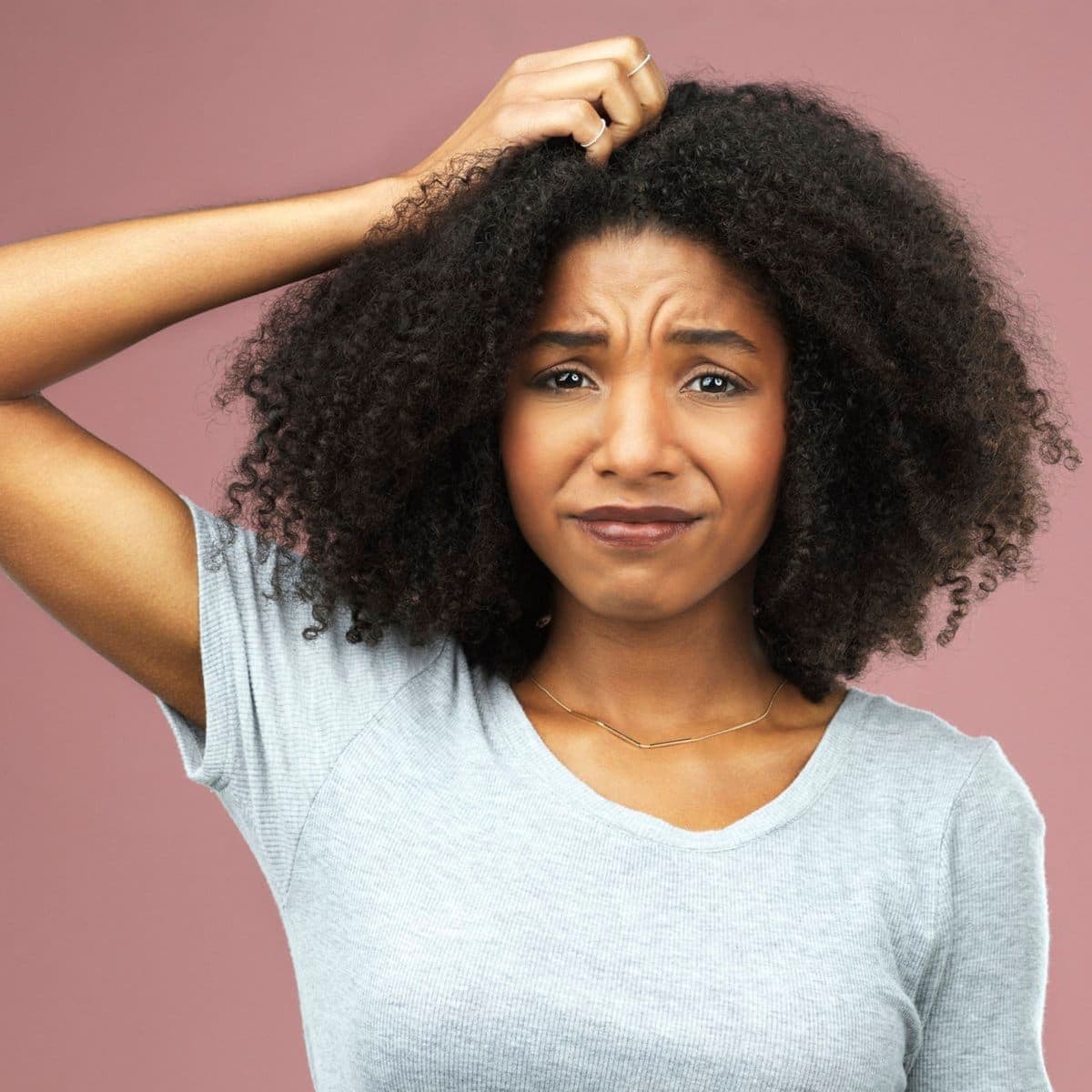 Woman texture hair dandruff