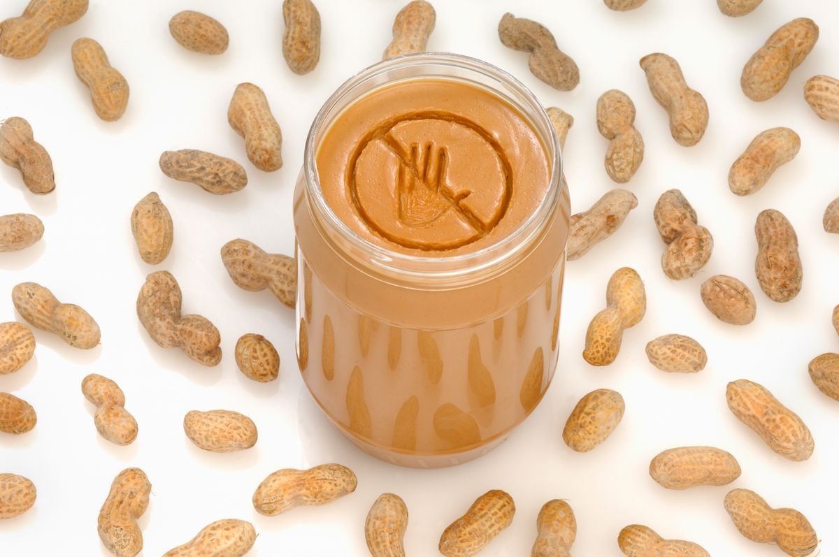 Food allergies are a serious health concern. Even small amounts of peanuts or tree nuts can trigger severe allergic reactions in some children.