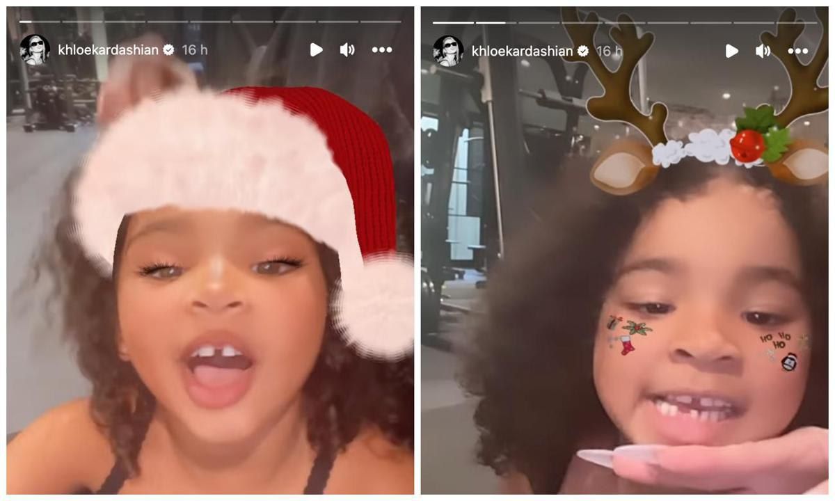 Khloé Kardashian welcomes the ‘Tooth Fairy’ as daughter True Thompson loses her first tooth
