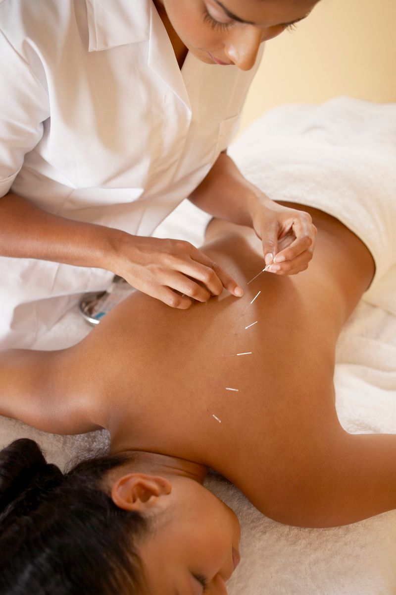 This traditional Chinese practice uses needles to restore an energy flow through specific points on the skin. It is used to relieve pain and to treat a wide range of disorders. 