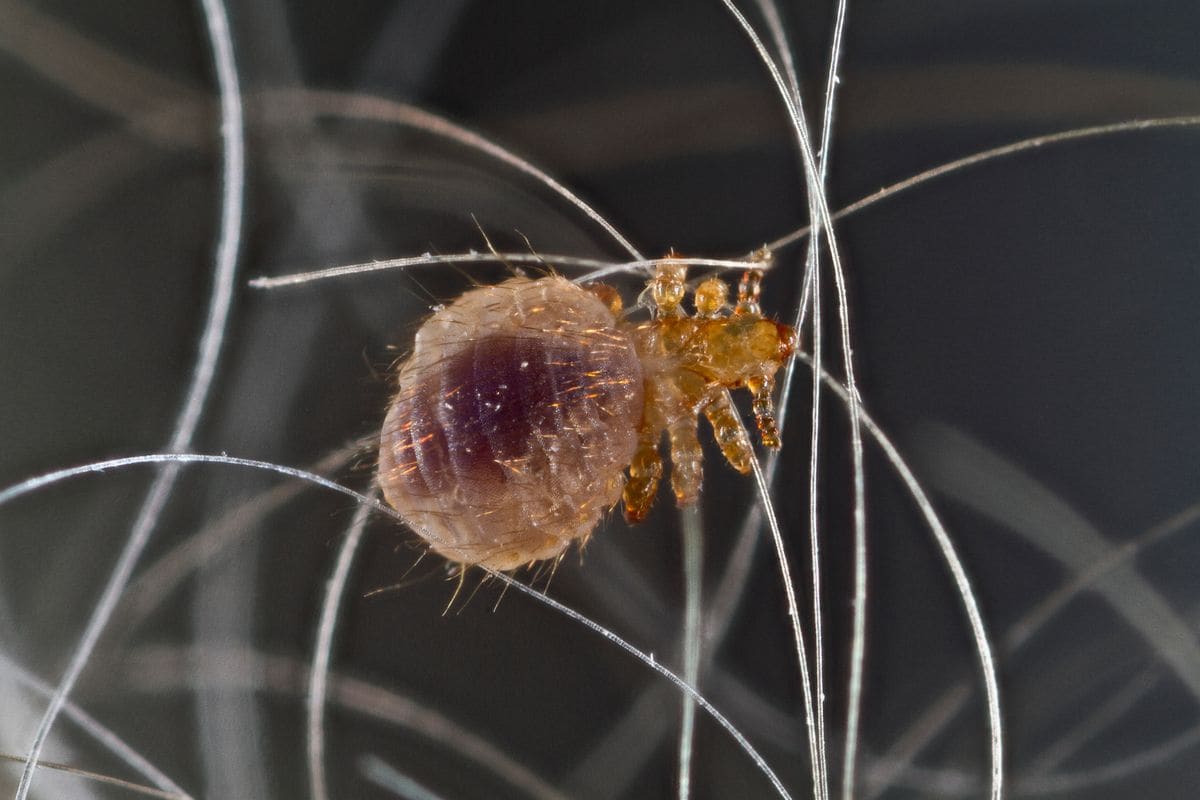 Head lice are wingless insects that can live on the human scalp and feed on human blood